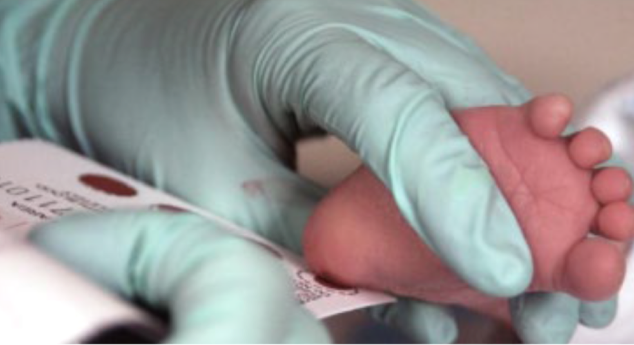 heelstick screening being performed on baby