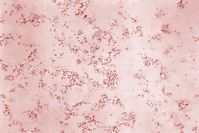 Francisella tularensis. Photo: CDC, Dr. W.A. Clark.